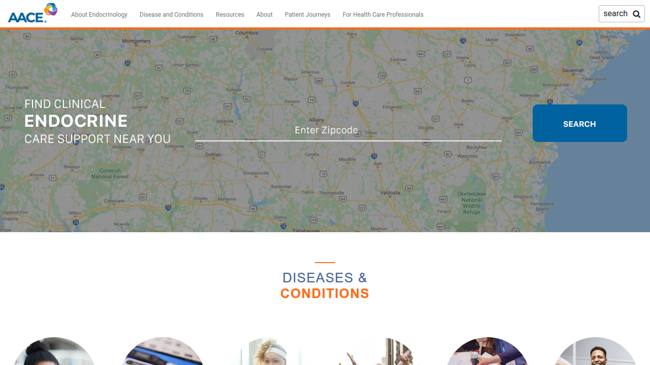 Screenshot of the American Association of Clinical Endocrinologists (AACE) website homepage, a professional organization offering medical guidance on endocrine health.